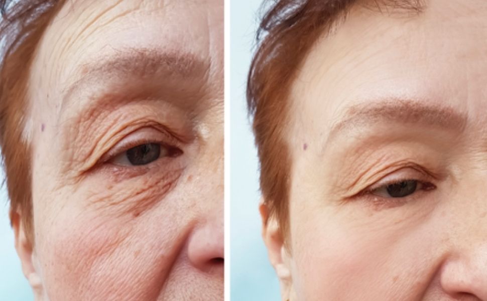Anti-Age Sommerpakke - Raz Skincare