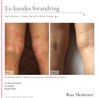 Anti - Irritation (Ai) 300ml - Raz Skincare
