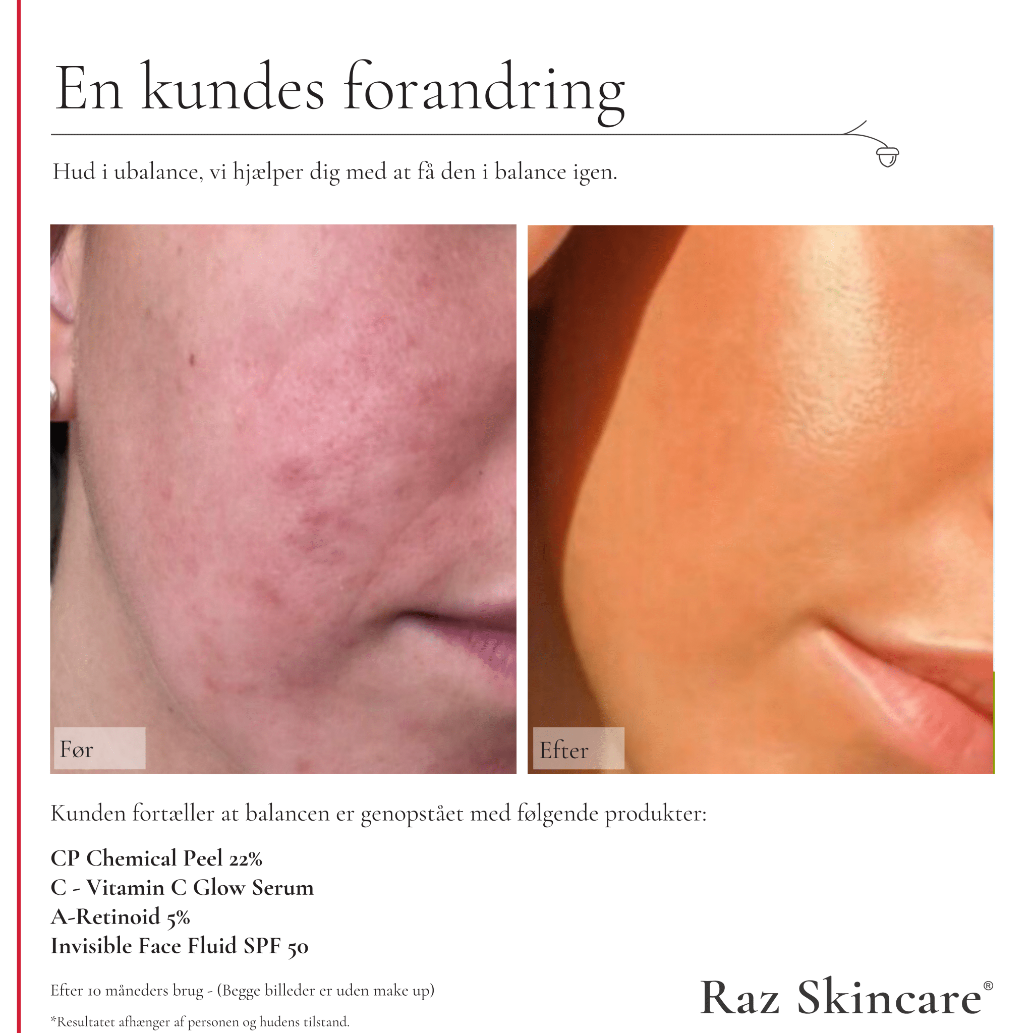C - Vitamin 30ml - Raz Skincare