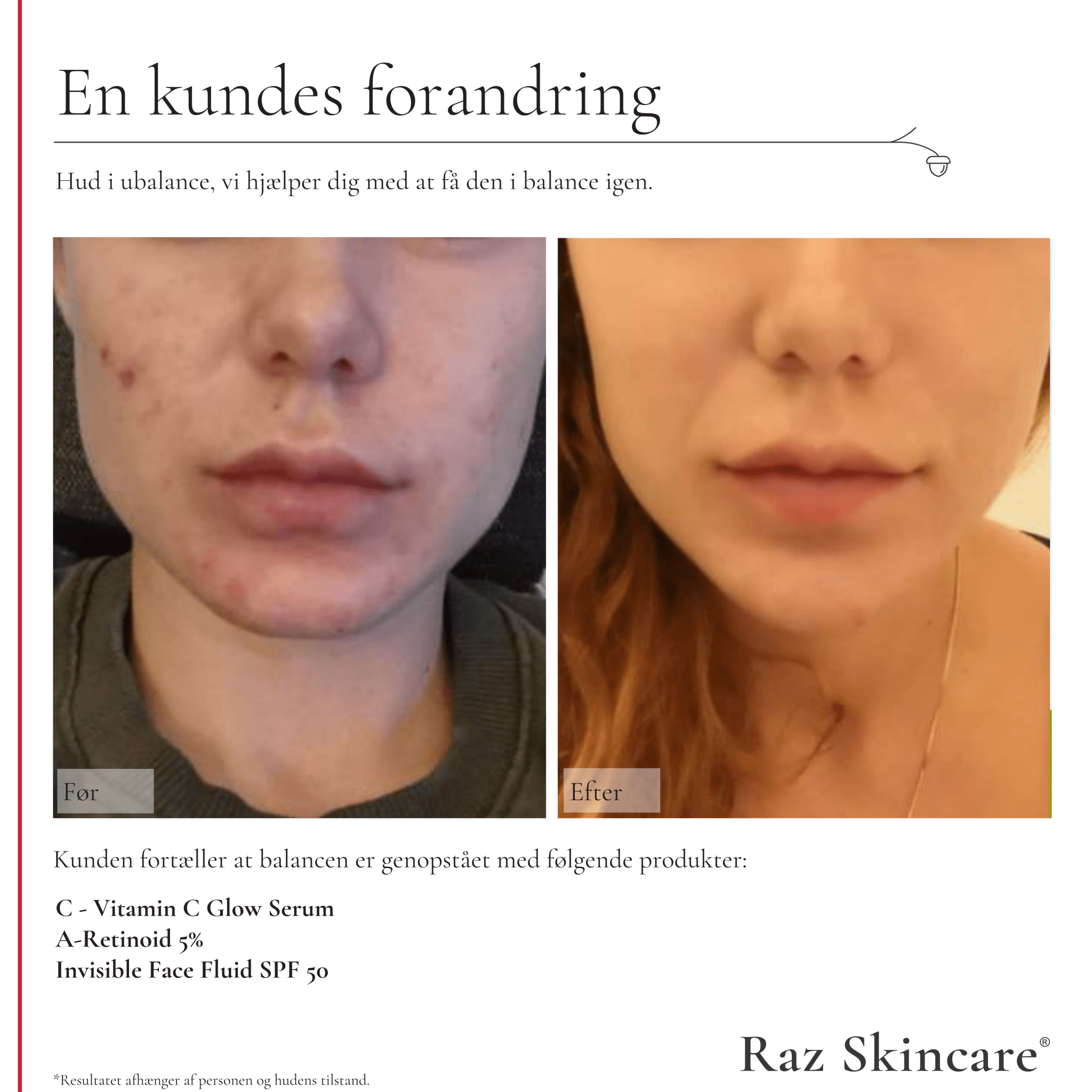 C - Vitamin 30ml - Raz Skincare