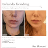 C - Vitamin 30ml - Raz Skincare