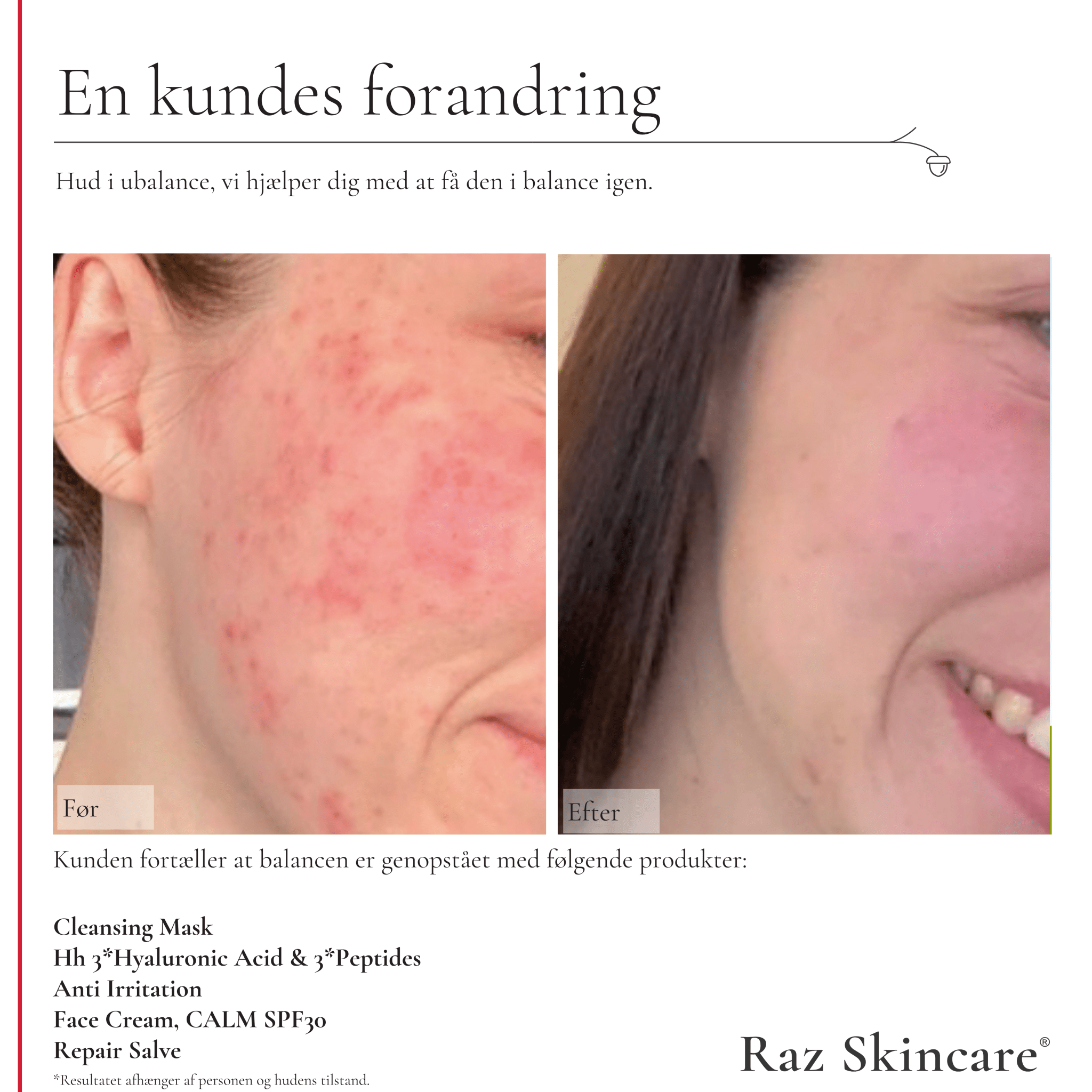 Repair Salve 15ml - Raz Skincare