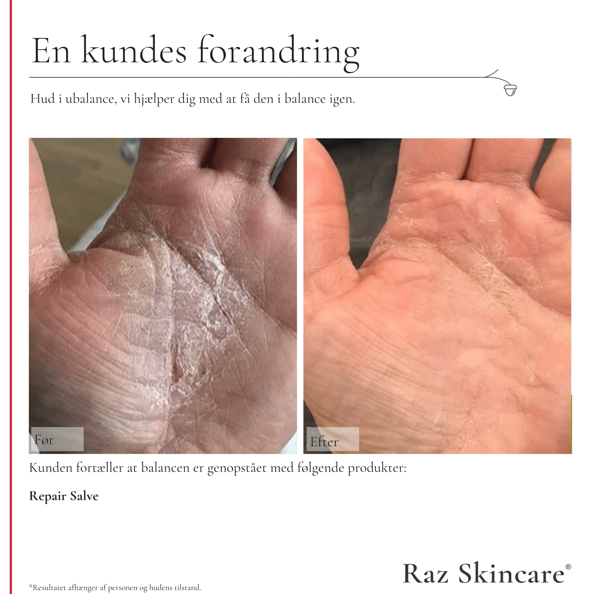 Repair Salve, Perfume free 100ml - Raz Skincare