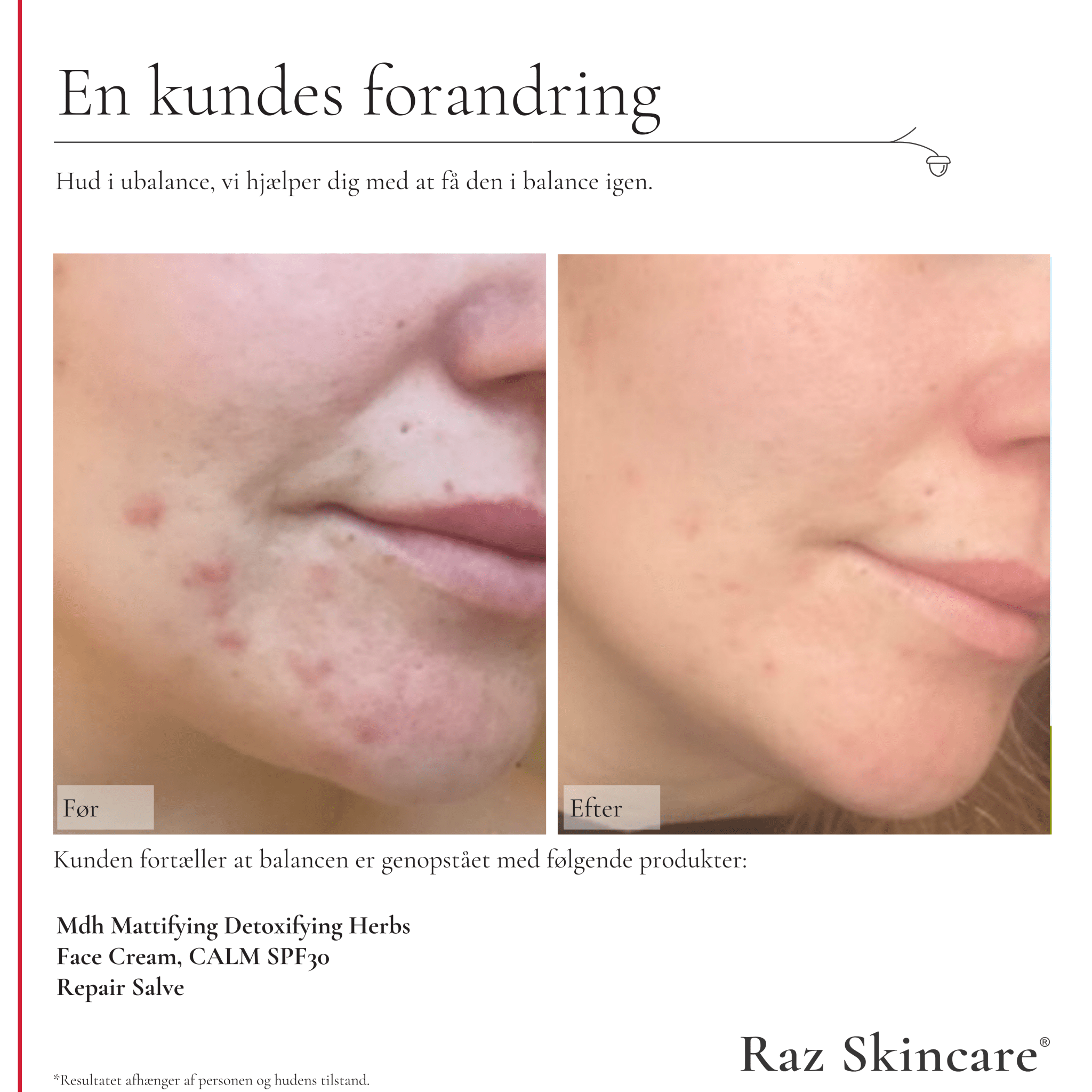 Repair Salve, Perfume free 15ml - Raz Skincare